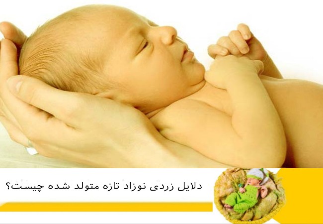 دلایل زردی نوزاد تازه متولد شده چیست؟
