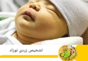 تشخیص زردی نوزاد