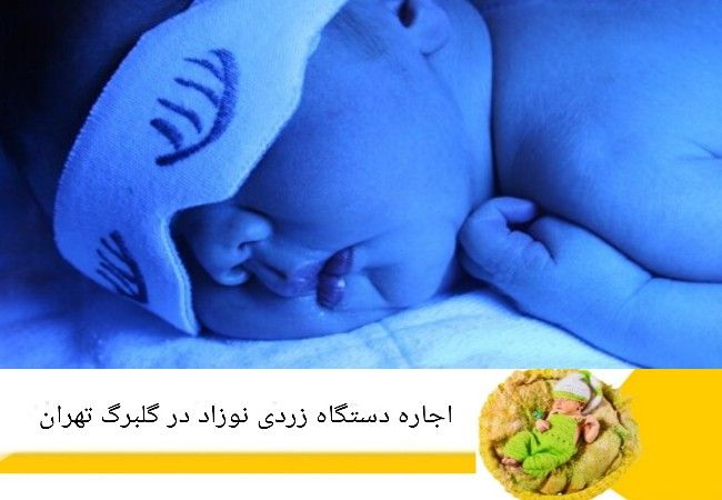 اجاره دستگاه زردی نوزاد در گلبرگ تهران